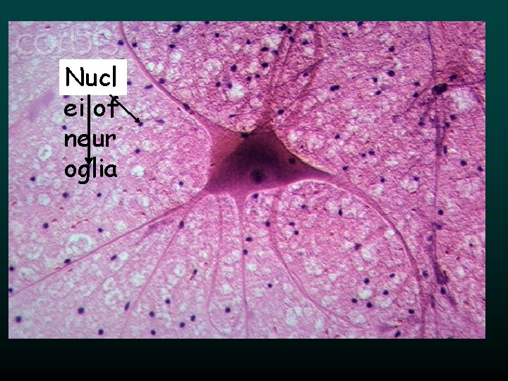 Nucl ei of neur oglia Nucl ei of neur oglia