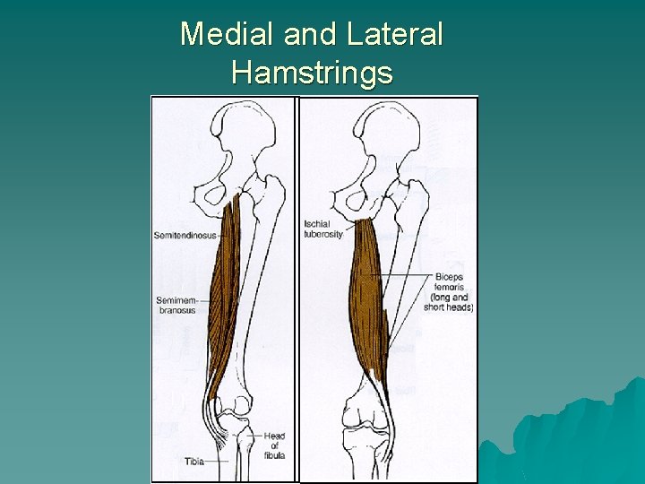 Medial and Lateral Hamstrings 
