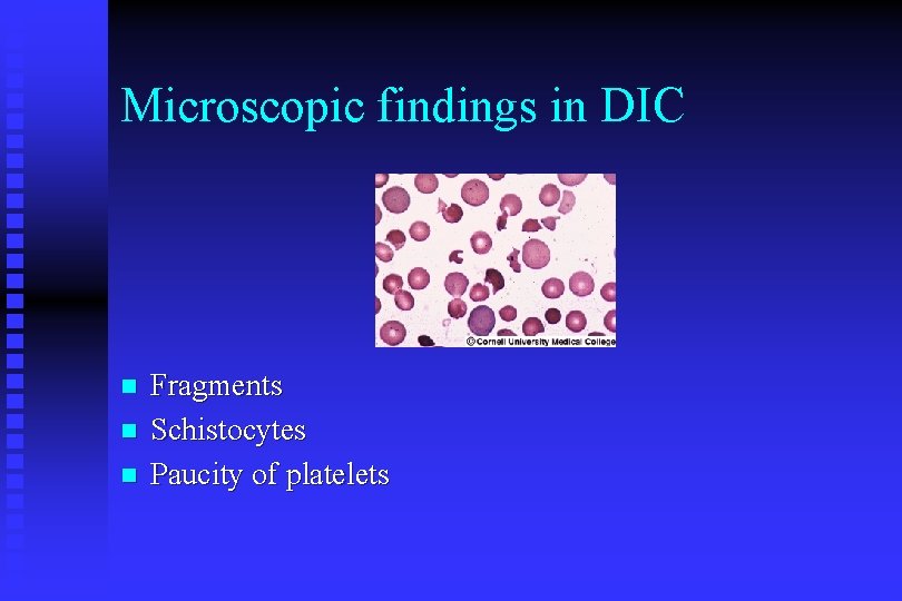 Microscopic findings in DIC n n n Fragments Schistocytes Paucity of platelets 