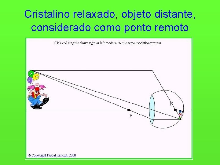 Cristalino relaxado, objeto distante, considerado como ponto remoto 