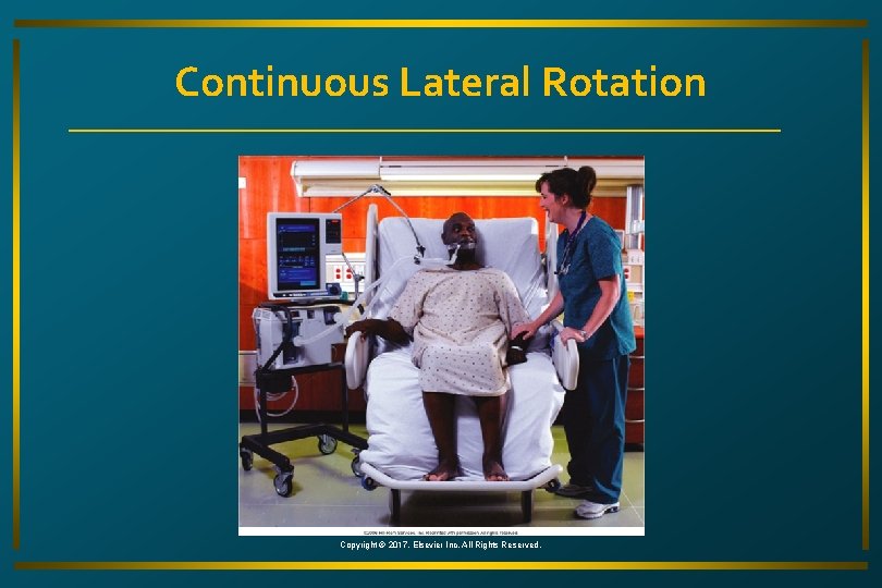 Continuous Lateral Rotation Copyright © 2017, Elsevier Inc. All Rights Reserved. 
