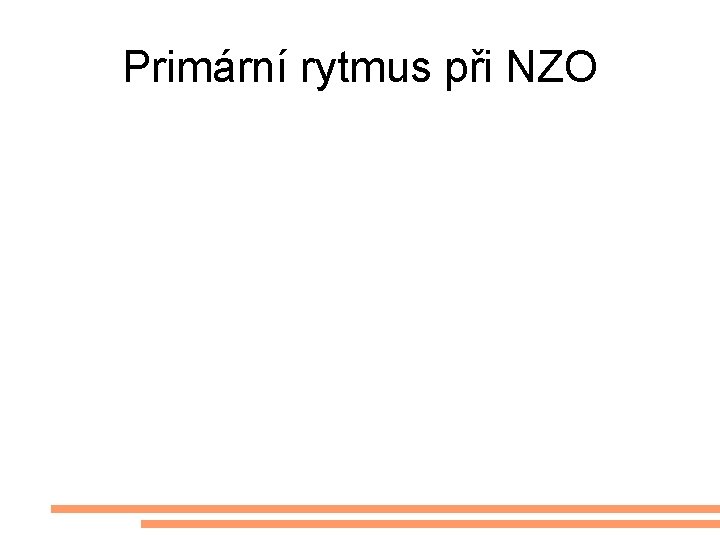 Primární rytmus při NZO 