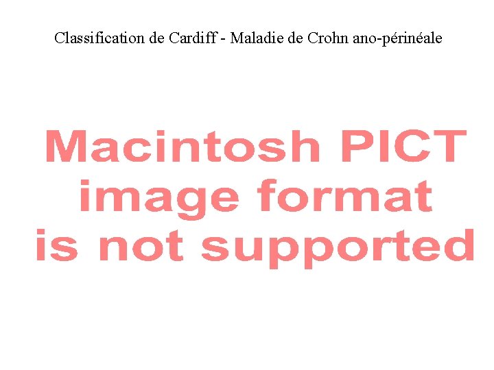 Classification de Cardiff - Maladie de Crohn ano-périnéale 