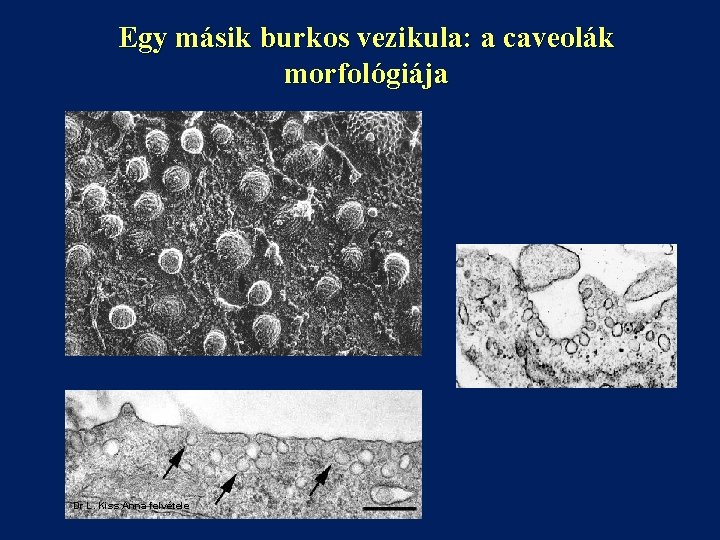 Egy másik burkos vezikula: a caveolák morfológiája Dr L. Kiss Anna felvétele 