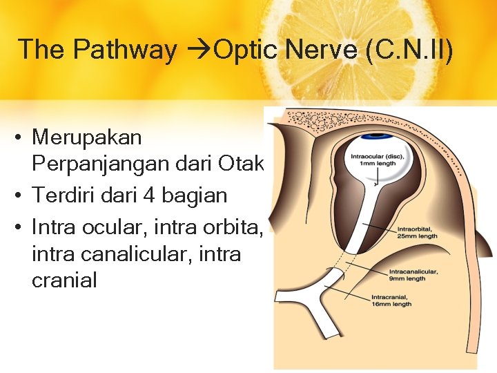 The Pathway Optic Nerve (C. N. II) • Merupakan Perpanjangan dari Otak • Terdiri