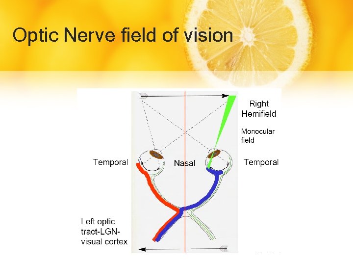 Optic Nerve field of vision 