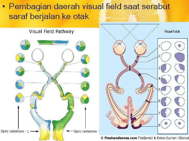  • Pembagian daerah visual field saat serabut saraf berjalan ke otak 