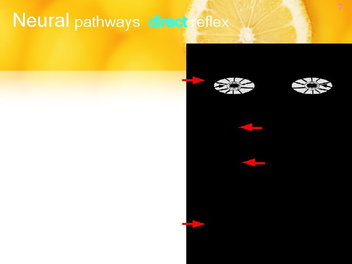 Neural pathways 7 direct reflex 