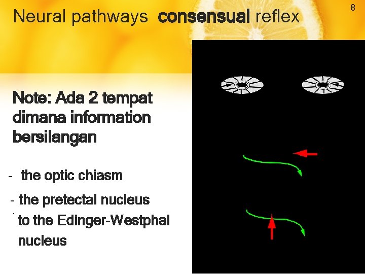 Neural pathways consensual reflex Note: Ada 2 tempat dimana information bersilangan - the optic