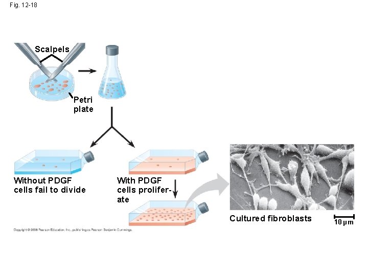 Fig. 12 -18 Scalpels Petri plate Without PDGF cells fail to divide With PDGF Fig. 12 -18 Scalpels Petri plate Without PDGF cells fail to divide With PDGF