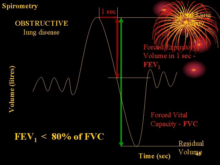 Spirometry 1 sec Total Lung Capacity Volume (litres) OBSTRUCTIVE lung disease Forced Expiratory Volume