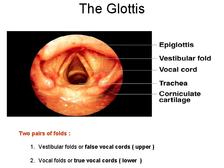 The Glottis Two pairs of folds : 1. Vestibular folds or false vocal cords