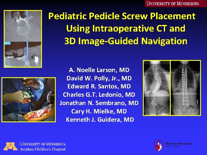 Pediatric Pedicle Screw Placement Using Intraoperative CT and 3 D Image-Guided Navigation A. Noelle