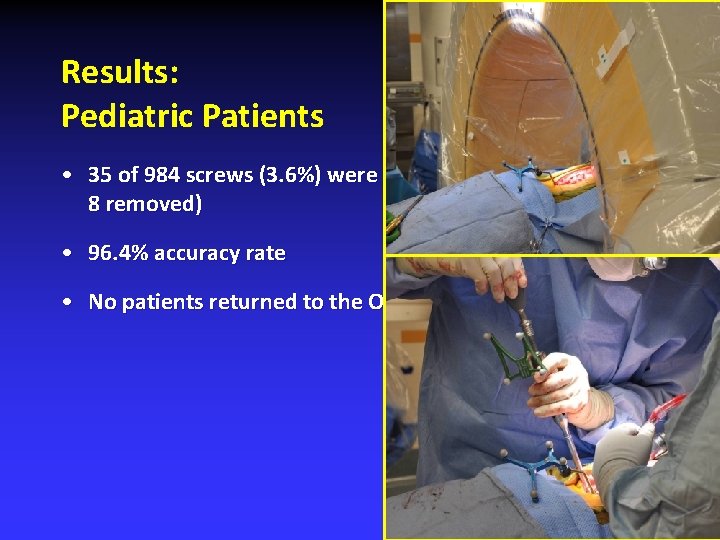 Results: Pediatric Patients • 35 of 984 screws (3. 6%) were revised (27 redirected,