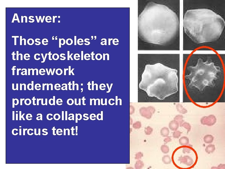 Answer: So, tell me why… Those “poles” • Why does a crenatedare erythrocyte (shriveled