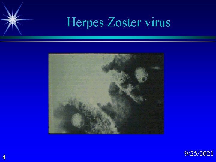 Herpes Zoster virus 4 9/25/2021 