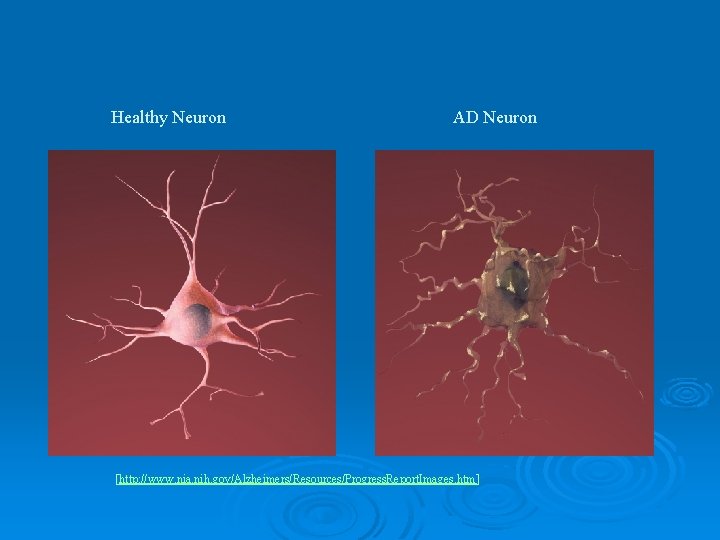 Treatment of Alzheimers Disease Jennifer Stearns 20 April