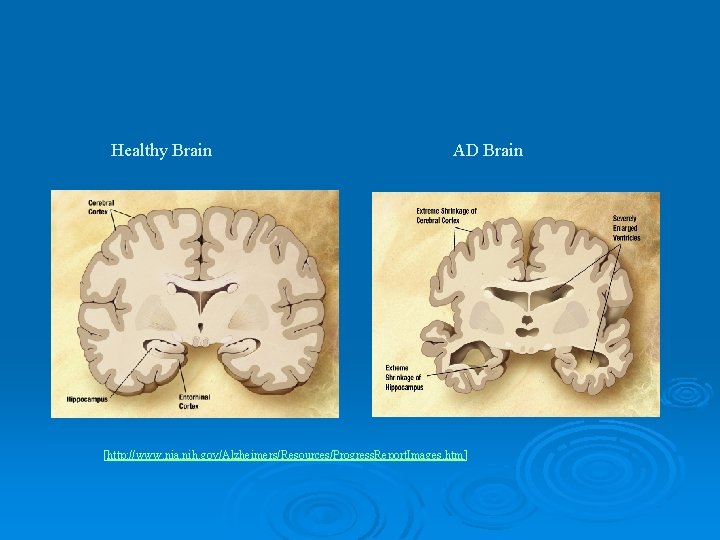 Treatment of Alzheimers Disease Jennifer Stearns 20 April