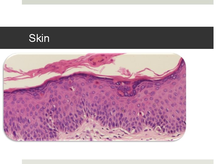 Skin 