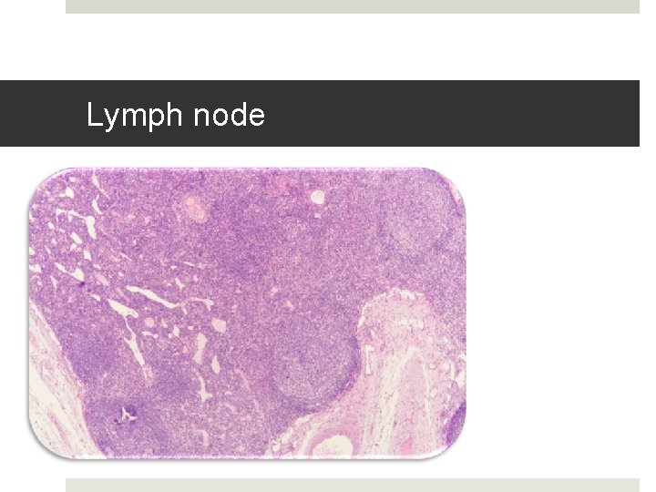 Lymph node 