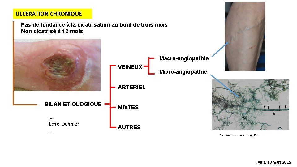 ULCERATION CHRONIQUE Pas de tendance à la cicatrisation au bout de trois mois Non