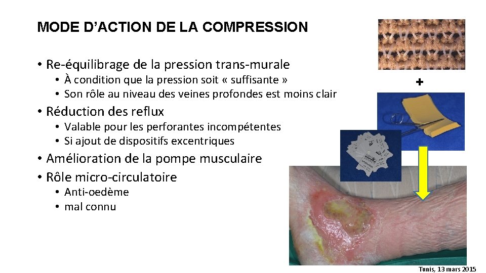 MODE D’ACTION DE LA COMPRESSION • Re-équilibrage de la pression trans-murale • À condition