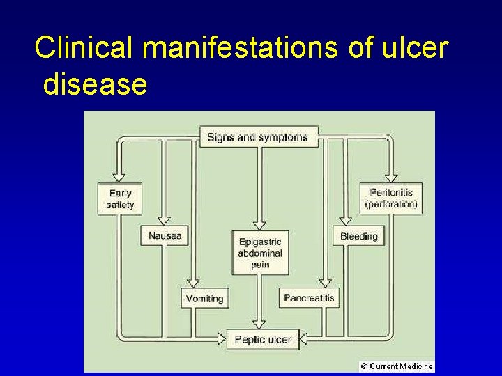 Clinical manifestations of ulcer disease 