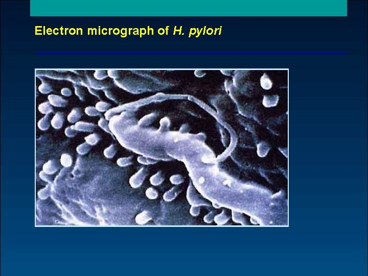 Electron micrograph of H. pylori 