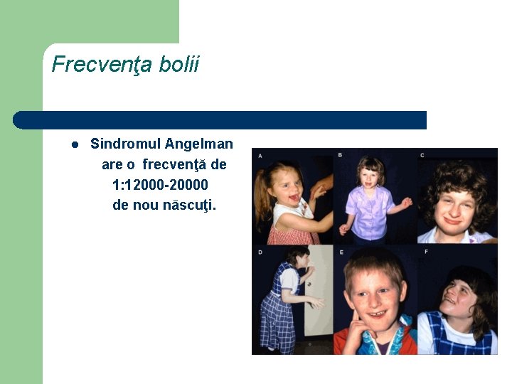 Frecvenţa bolii l Sindromul Angelman are o frecvenţă de 1: 12000 -20000 de nou