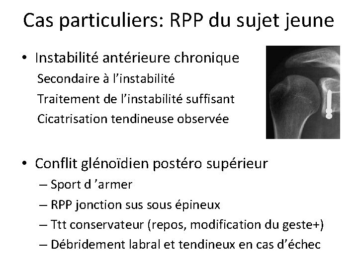Cas particuliers: RPP du sujet jeune • Instabilité antérieure chronique Secondaire à l’instabilité Traitement