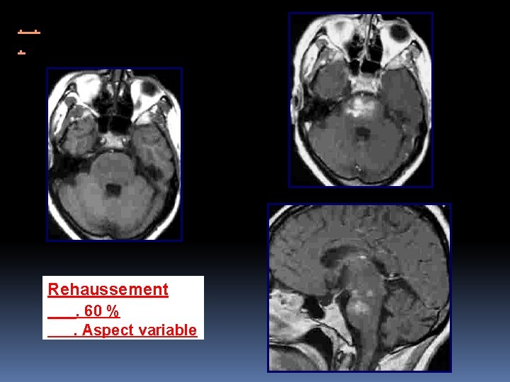 . . . Rehaussement. 60 %. Aspect variable 