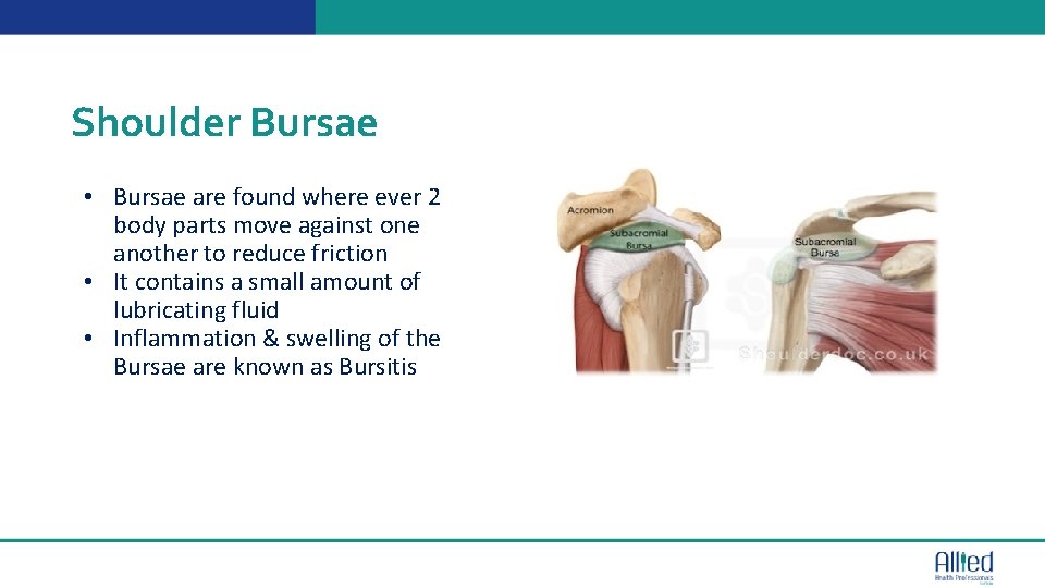 Shoulder Bursae • Bursae are found where ever 2 body parts move against one