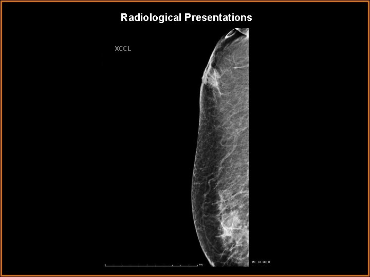 Radiological Presentations XCCL 