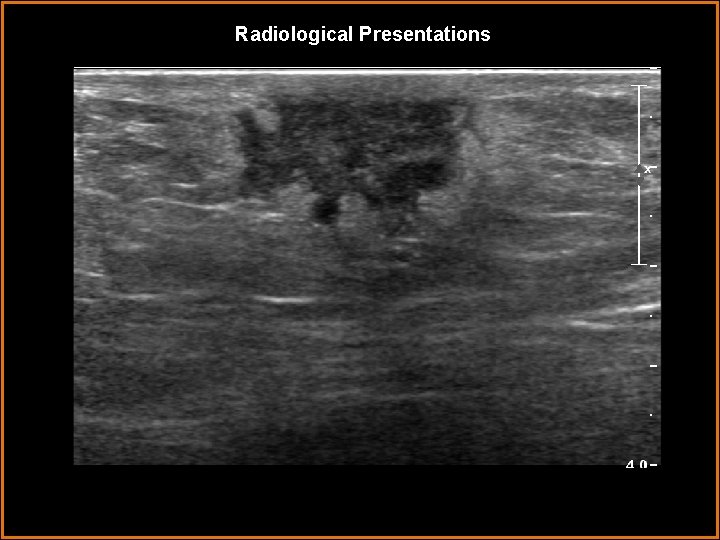 Radiological Presentations 