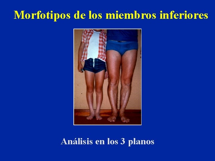 Morfotipos de los miembros inferiores Análisis en los 3 planos 