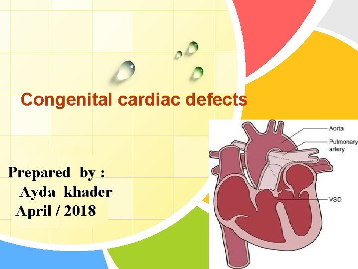 Congenital cardiac defects Prepared by : Ayda khader L/O/G/O April / 2018 