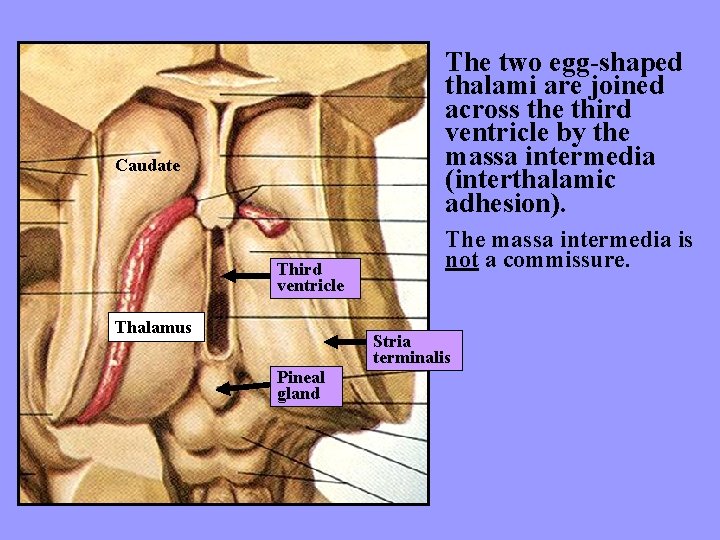 The two egg-shaped thalami are joined across the third ventricle by the massa intermedia
