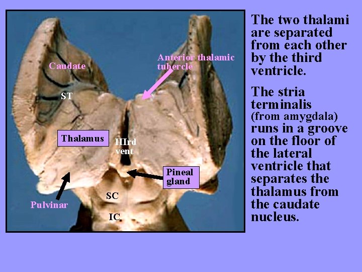 Anterior thalamic tubercle Caudate The two thalami are separated from each other by the