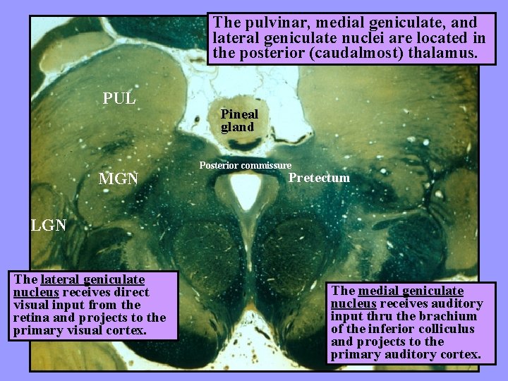 The pulvinar, medial geniculate, and lateral geniculate nuclei are located in the posterior (caudalmost)