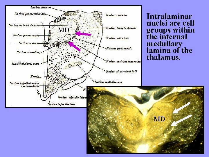 MD Intralaminar nuclei are cell groups within the internal medullary lamina of the thalamus.