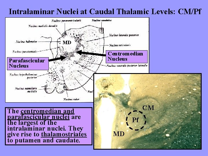 Intralaminar Nuclei at Caudal Thalamic Levels: CM/Pf MD Parafascicular Nucleus The centromedian and parafascicular