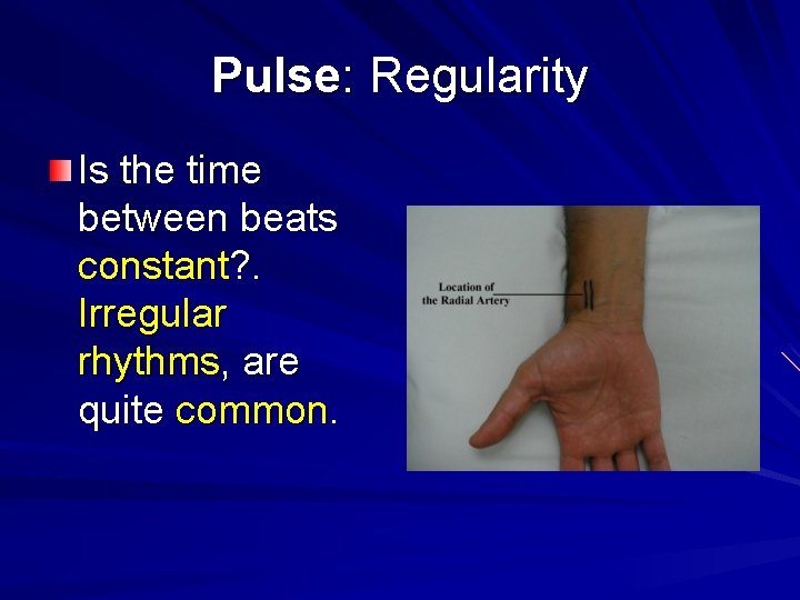 Pulse: Regularity Is the time between beats constant? . Irregular rhythms, are quite common.