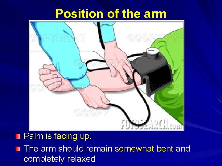 Position of the arm Palm is facing up. The arm should remain somewhat bent