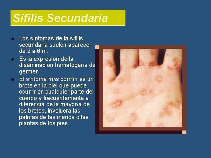 Sifilis Secundaria l l l Los síntomas de la sífilis secundaria suelen aparecer de