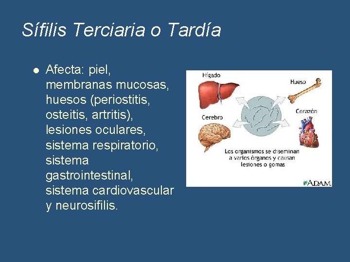 Sífilis Terciaria o Tardía l Afecta: piel, membranas mucosas, huesos (periostitis, osteitis, artritis), lesiones