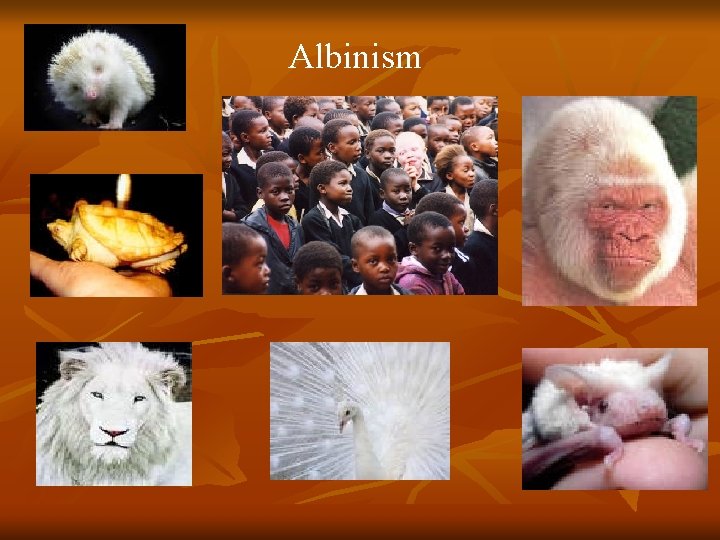 Albinism 