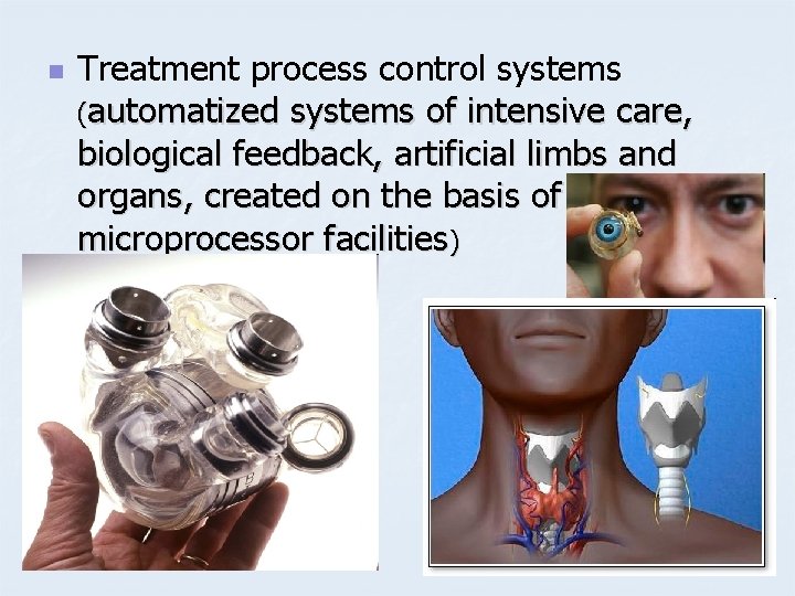 n Treatment process control systems (automatized systems of intensive care, biological feedback, artificial limbs