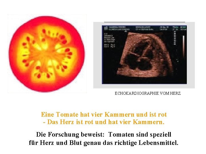 ECHOKARDIOGRAPHIE VOM HERZ Eine Tomate hat vier Kammern und ist rot - Das Herz