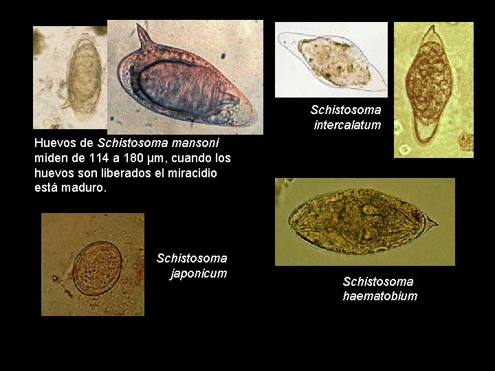 Schistosoma intercalatum Huevos de Schistosoma mansoni miden de 114 a 180 µm, cuando los