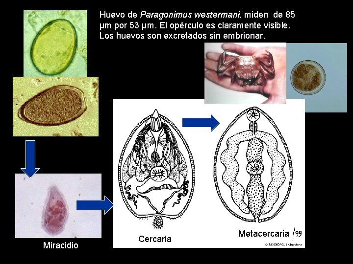 Huevo de Paragonimus westermani, miden de 85 µm por 53 µm. El opérculo es
